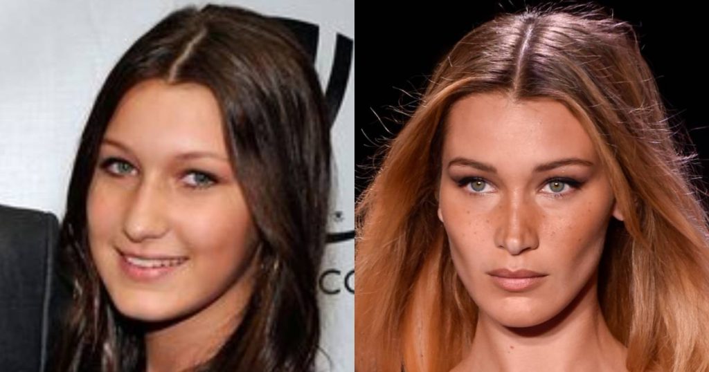 Bella Hadid Underwent Rhinoplasty at age 14 because she felt like 'Gigi's ugly sister': 'Don't let the rest run on my face' |  celebrities