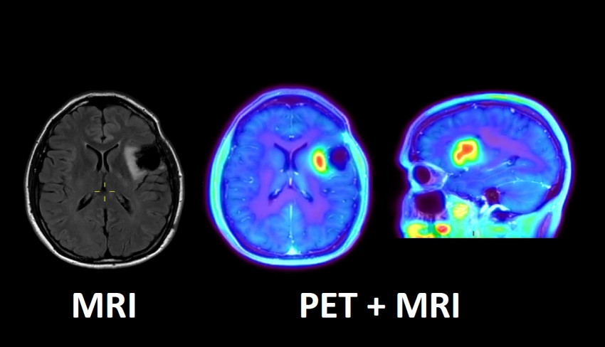 FAT PET-MRI with text