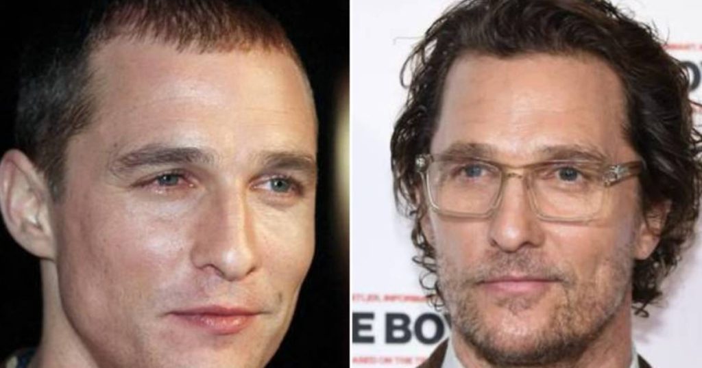 No, Matthew McConaughey did not have a hair transplant |  celebrities